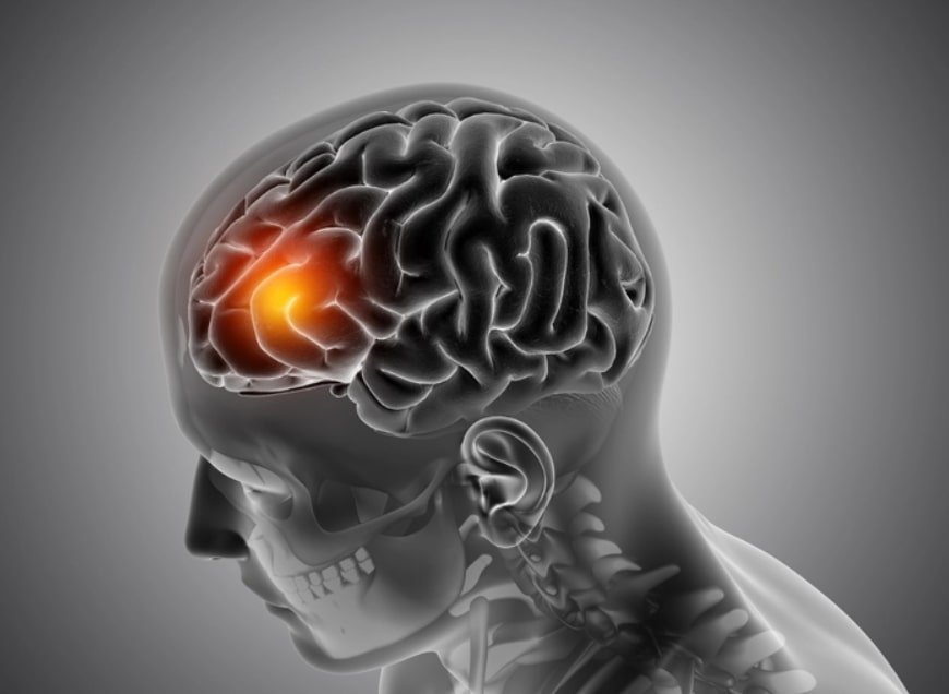 Alzheimer’s Disease: Early Detection and Prevention Tips