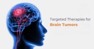 What Are the Latest Advancements in Targeted Therapies for Brain Tumours?