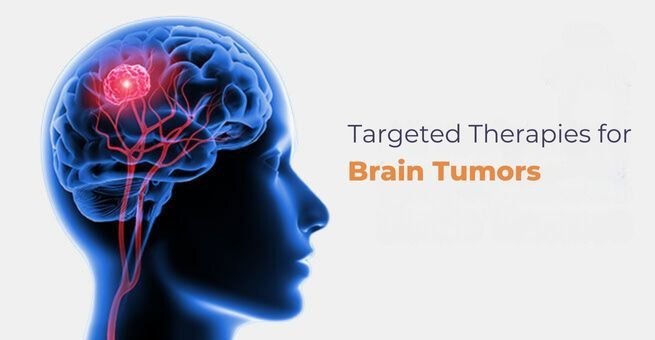 What Are the Latest Advancements in Targeted Therapies for Brain Tumours?