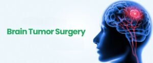 What Are the Key Symptoms, Causes, and Advances in Brain Tumour Surgery?