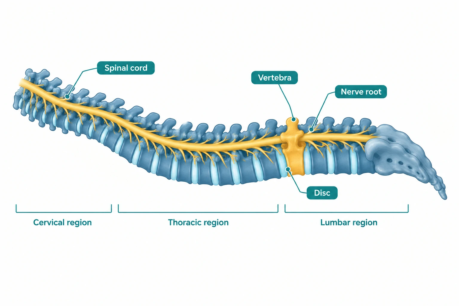 Labelled diagram of the spine showing vertebrae, discs, spinal cord and nerve roots in spinal injury