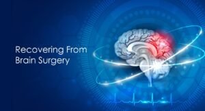 Recovering from Brain Surgery: Tips for a Faster and Safer Recovery