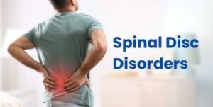Spinal Disc Disorders: What Are Its Causes, Symptoms, and Treatment Options?