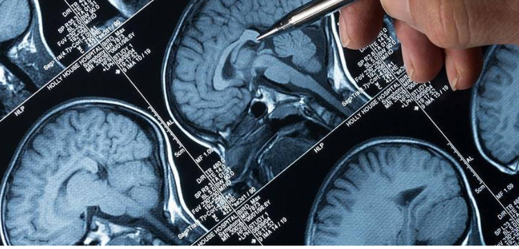 From Diagnosis to Treatment: What Role Does Neuro-Oncology Play in Enhancing Patient Outcomes?