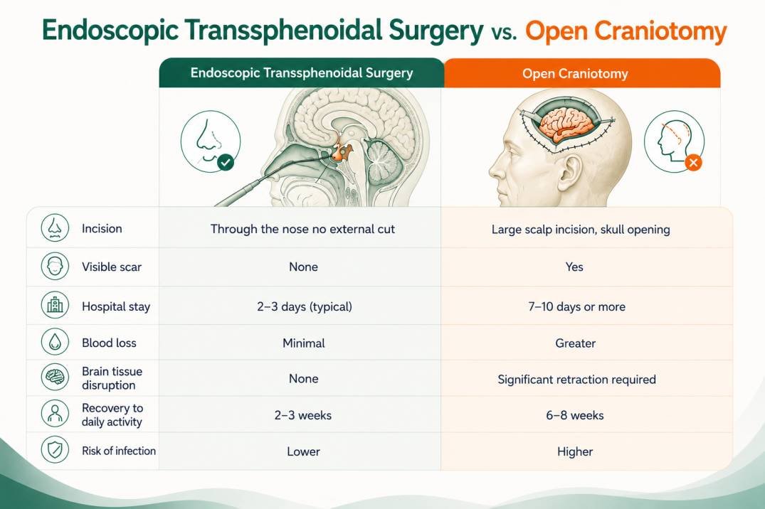 Infographic comparing endoscopic transsphenoidal pituitary surgery with open craniotomy