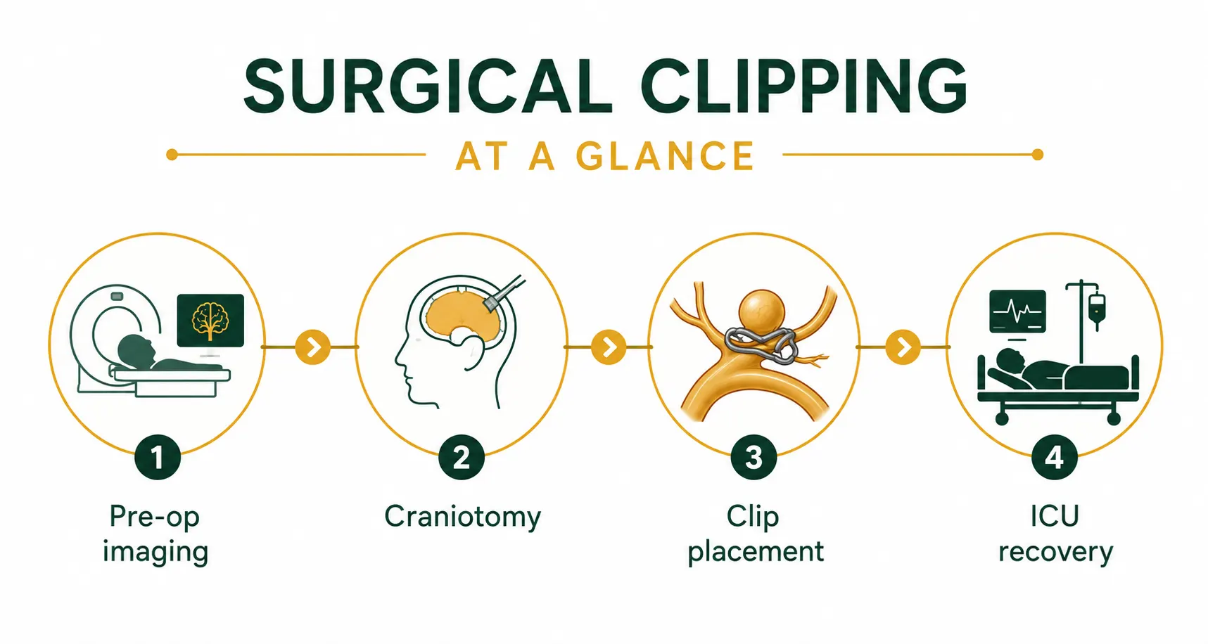 Infographic showing the surgical clipping procedure timeline for brain aneurysm treatment. Best Neurosurgeon in Delhi. Surgical Clipping in Delhi