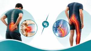 Slip Disc vs Sciatica: How to Tell the Difference