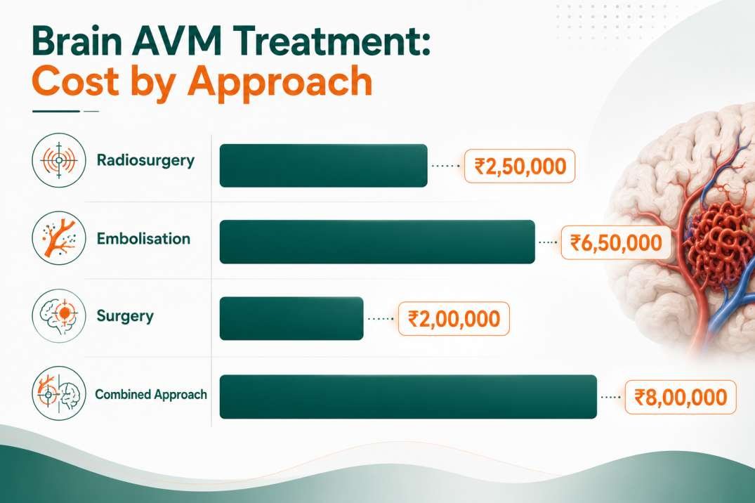Brain AVM Treatment Cost in Delhi