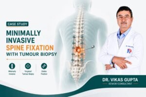 Minimally Invasive Spine Fixation with Tumour Biopsy