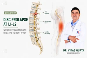 Spinal Fusion Surgery for Disc Prolapse and Spinal Instability